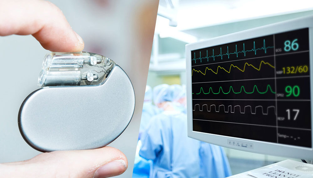 Improve Quality of Connected Medical Devices: Effective Manufacturing Test Strategies